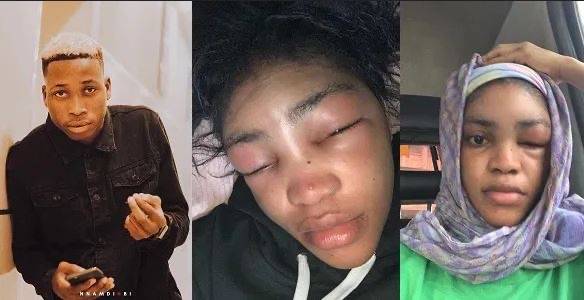 The Girl Beaten By Davido Former Artist, Lil Frosh Finally Reveals What Caused Their Fight (Photos)